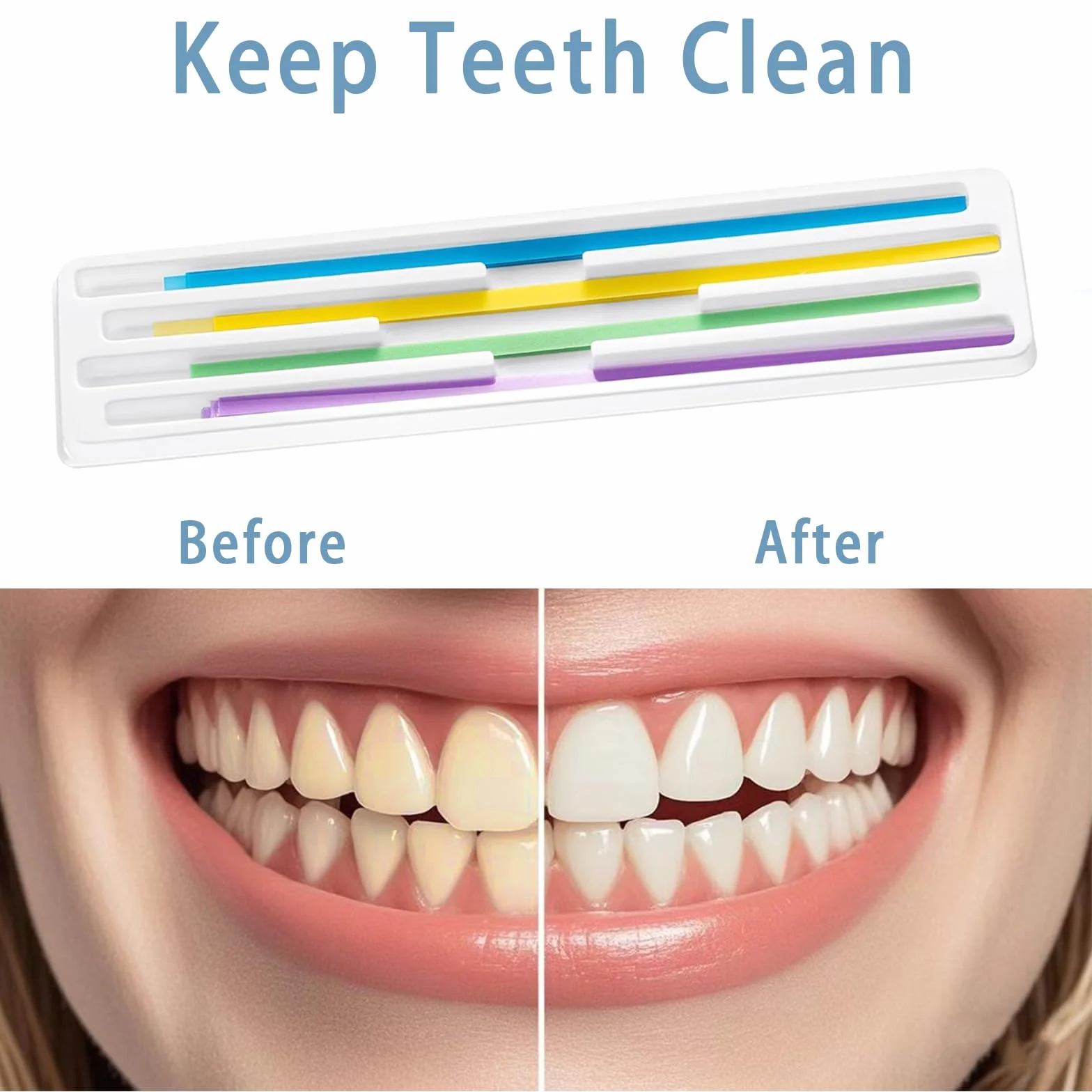 Juego de 80 tiras para pulir dientes
