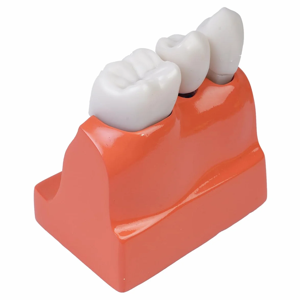 Sarini Modelo de Diente Oral, Modelo de implante Dental con Corona y Puente extraíbles para demostración y formación