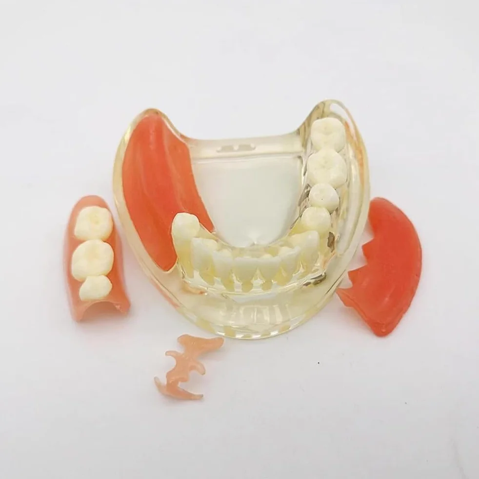 Implant-Supported Restorations Comparison Model Transparent Dental Implant Model Education Study