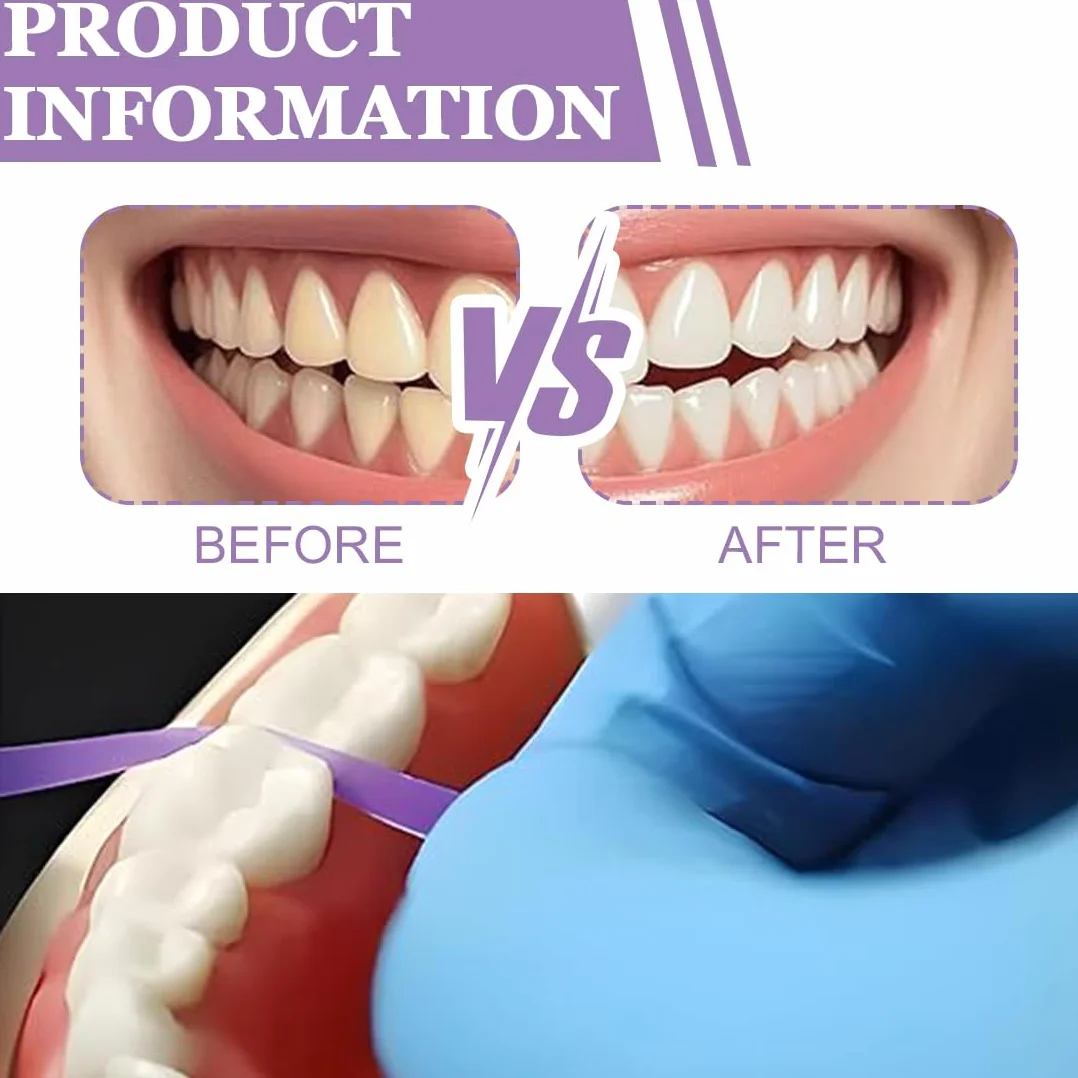Tiras De Pulido Dental Doble Cara 50µm Papel De Lija Dental Para Limpieza Profunda