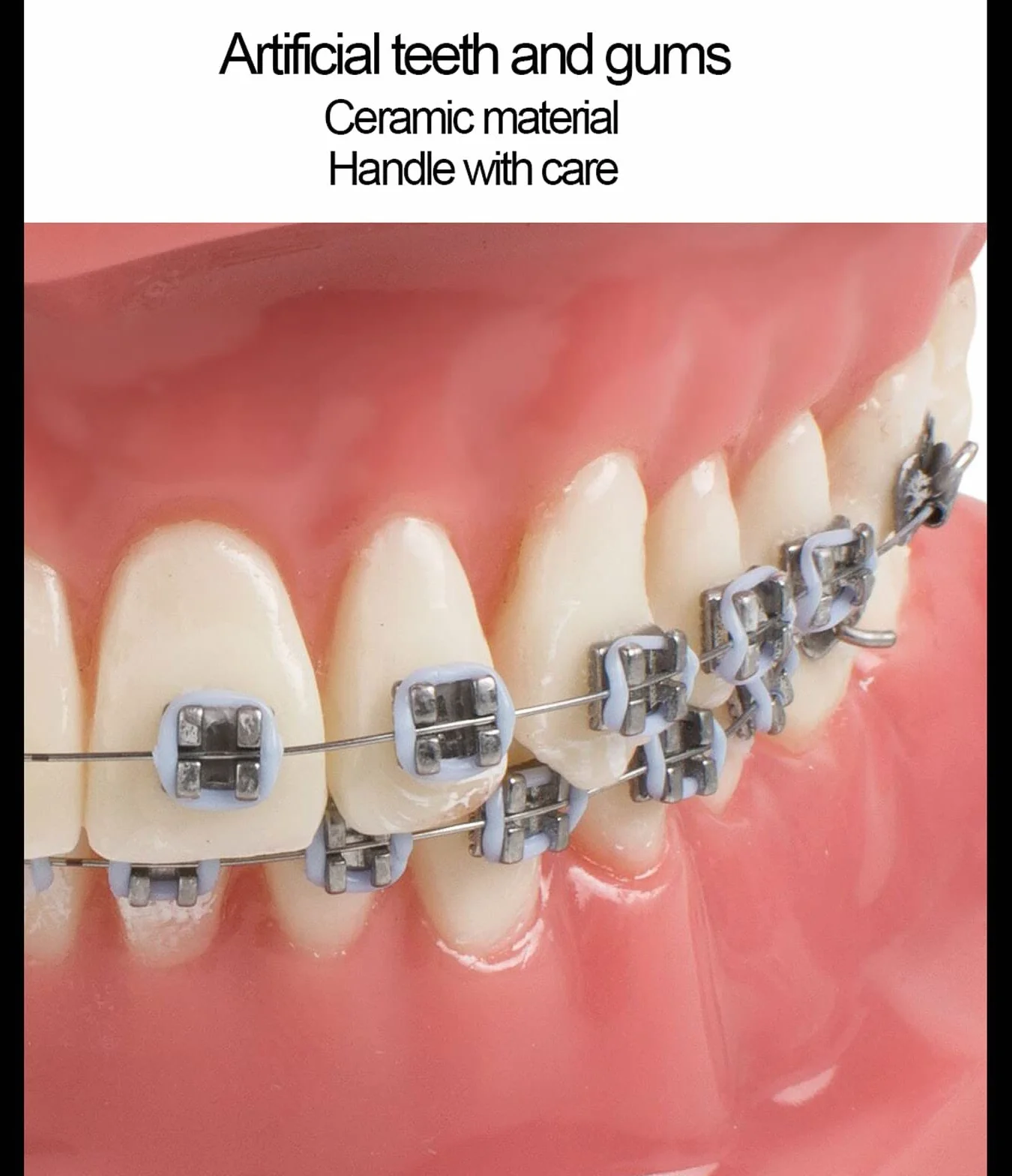 Modelo de Dientes Dentales de Ortodoncia con Brackets Cerámicos y Metálicos para Enseñanza Odontológica