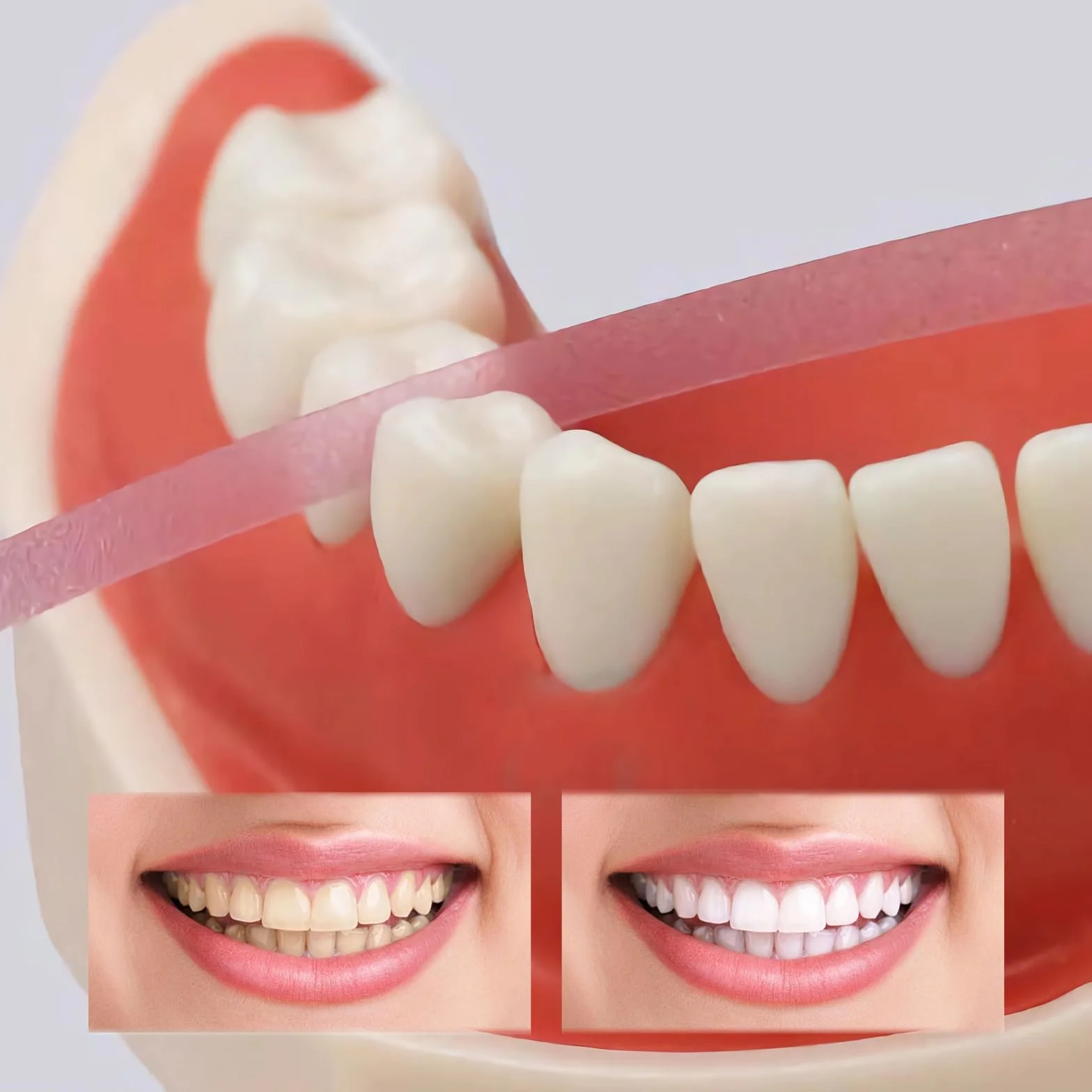 SNONESIY Papel de Lija Dental 4 mm x 6 m, Tiras de Pulido Dental para Espacios Intermedios, Eliminador de Sarro
