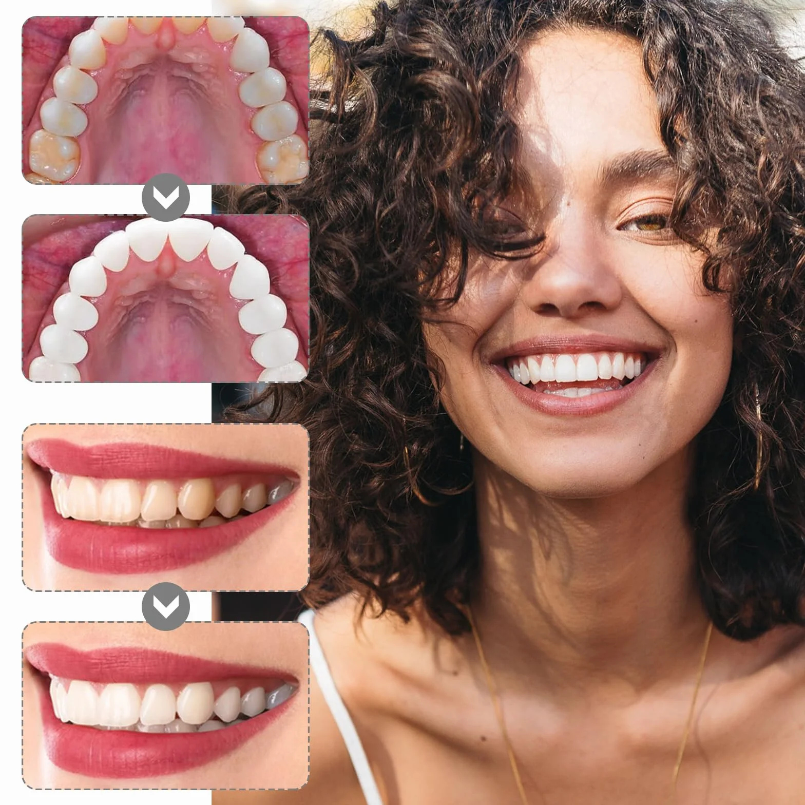 Papel De Lija Dental Tiras De Lijado Dental Tira De Pulido Dental Dientes Abrasivos 5 Pcs
