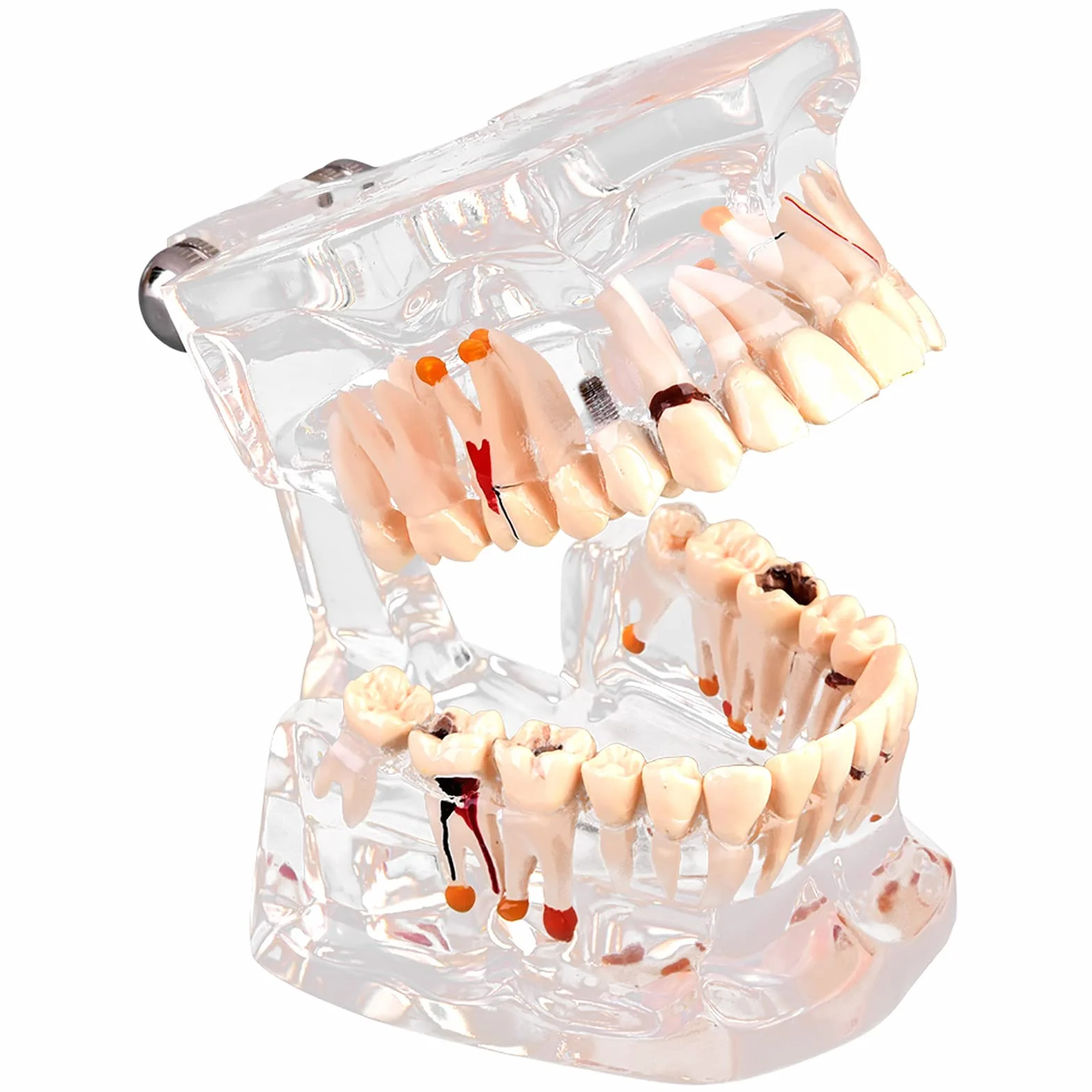 Modelo de Dientes Estándar para Estudiantes de Odontología, Herramienta Educativa Transparente