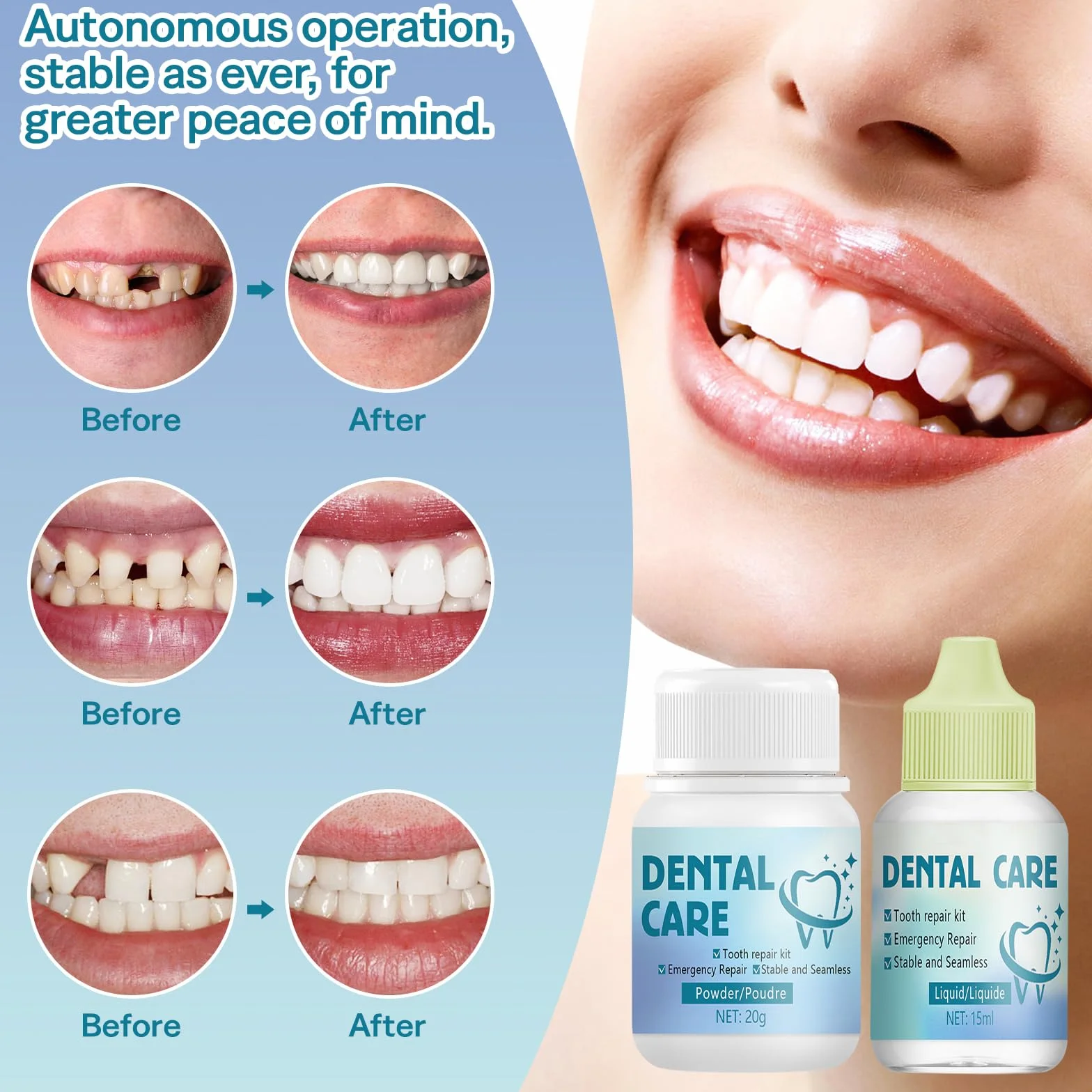Cemento Dental Kit Reparación Relleno Temporal para Corona Puente Caries