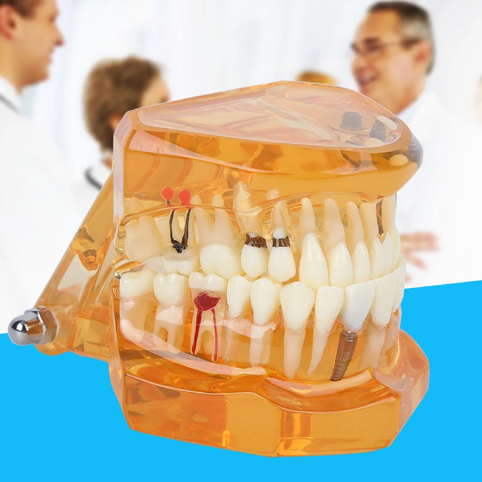 Modelo de Estudio de Dientes Dentales Extraíbles para Enseñanza Demostración Sobredentadura Maxilar Clínica Laboratorio Dentista