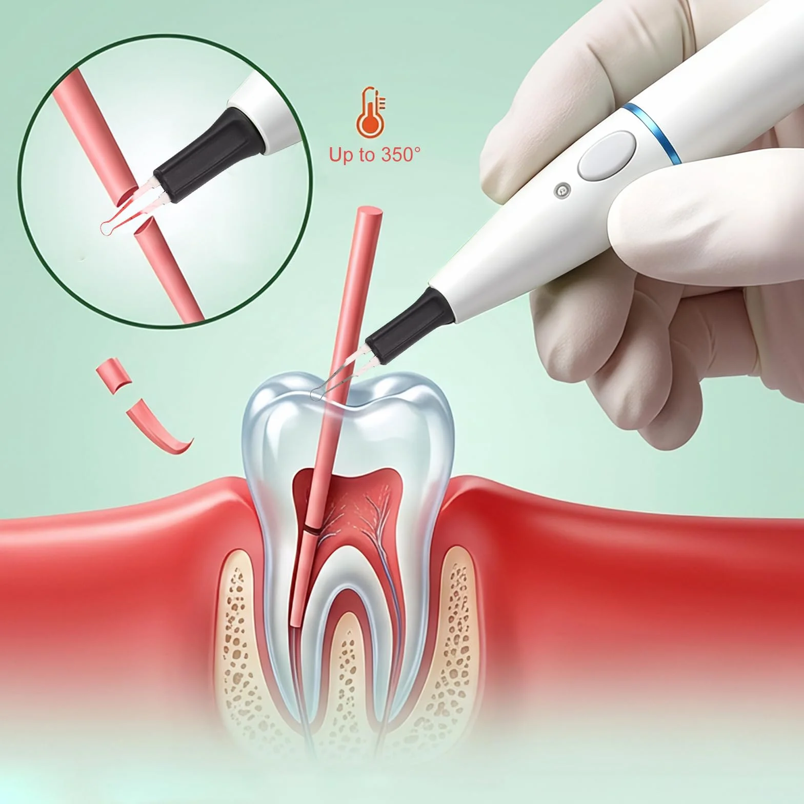 Gutta Percha Cutter Obturation Pen 4 Consejos