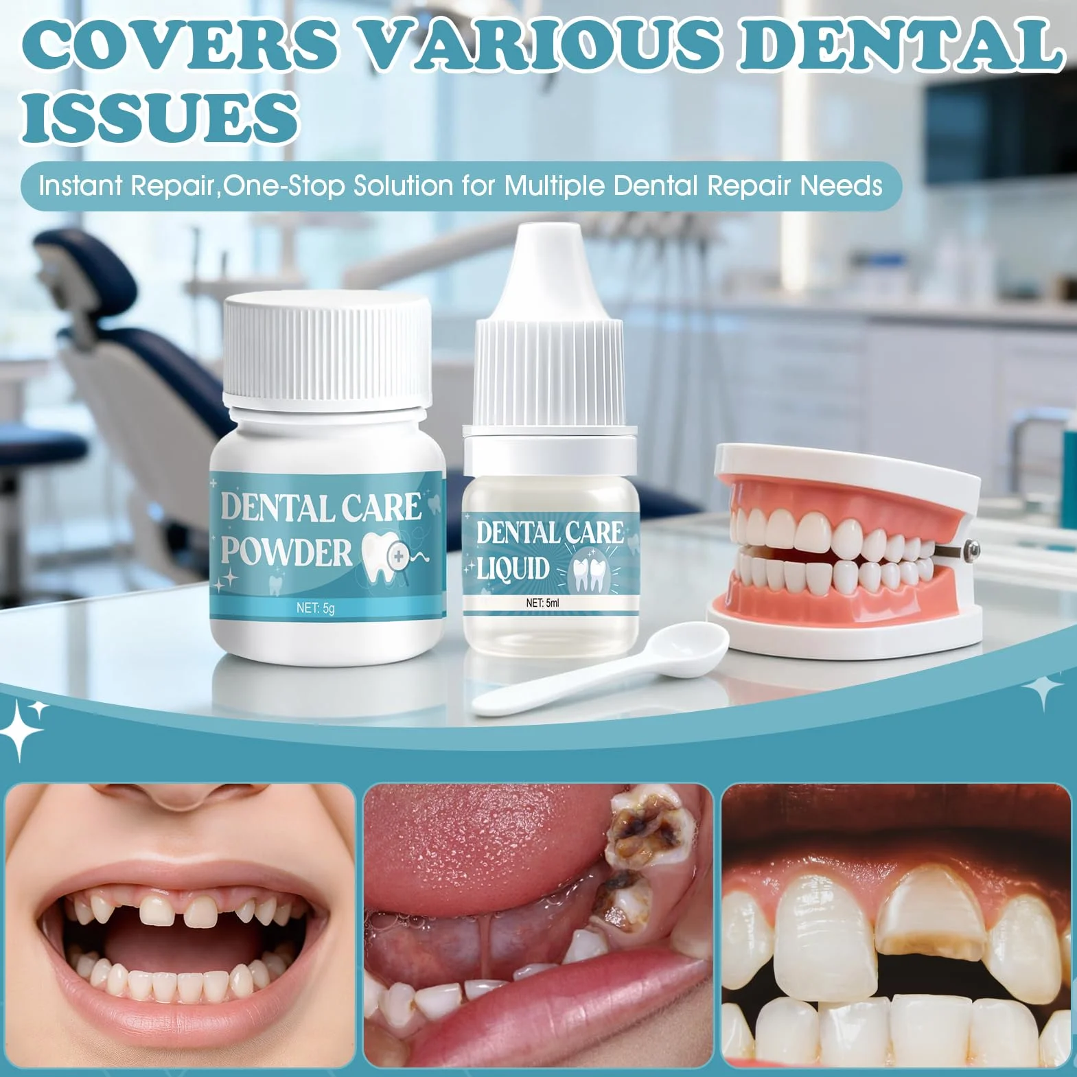 Pegamento Dental Cemento Kit de Fijación para Corona Puente Rellenar Caries