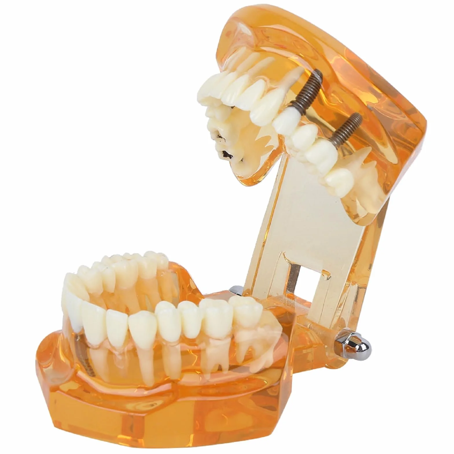 Modelo de Estudio de Dientes Dentales Extraíbles para Enseñanza Demostración Sobredentadura Maxilar Clínica Laboratorio Dentista