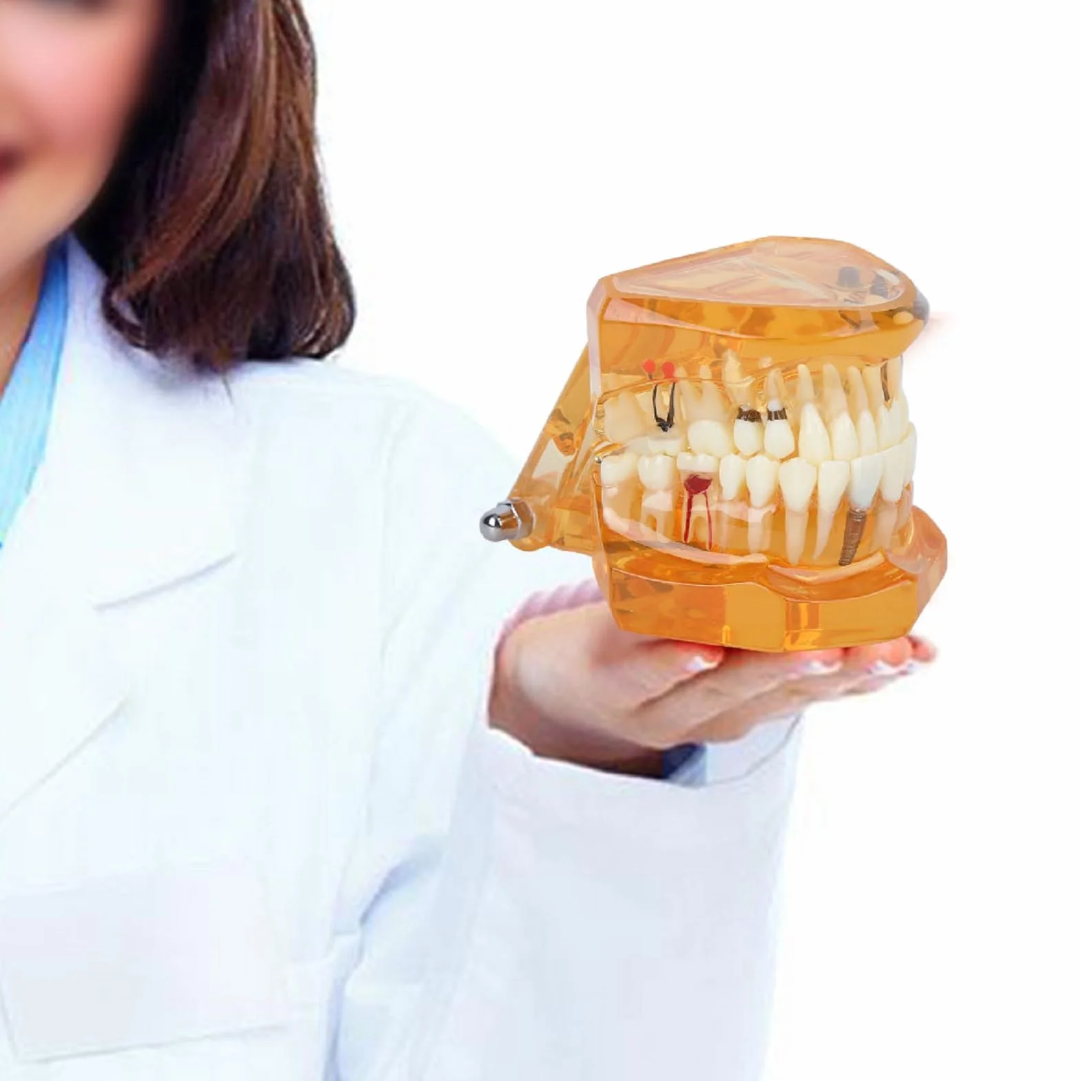 Modelo de Estudio de Dientes Dentales Extraíbles para Enseñanza Demostración Sobredentadura Maxilar Clínica Laboratorio Dentista