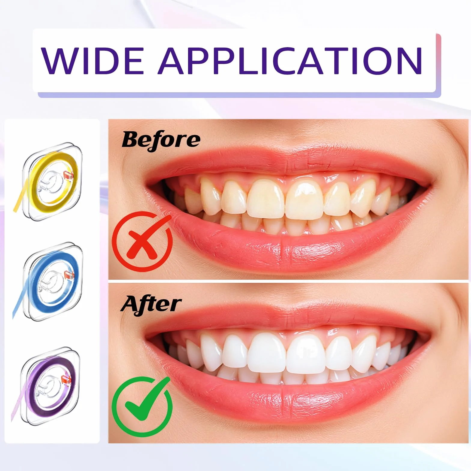 Papel abrasivo dental 3 bandas de pulido 20 30 50 μm 4 mm x 6 M para espacios intermedios