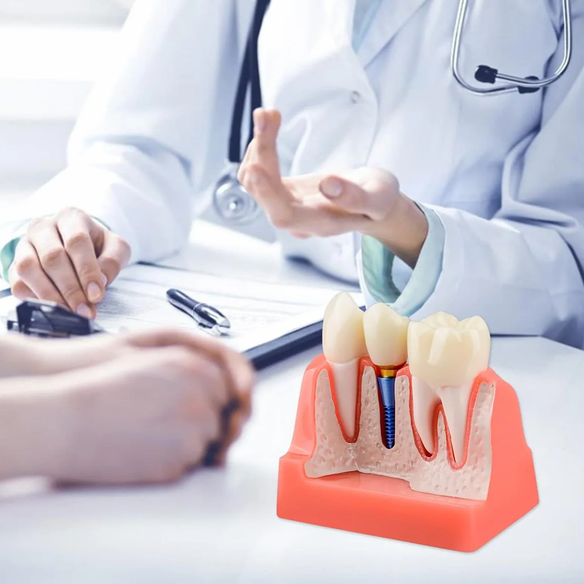 Sarini Modelo de Diente Oral, Modelo de implante Dental con Corona y Puente extraíbles para demostración y formación