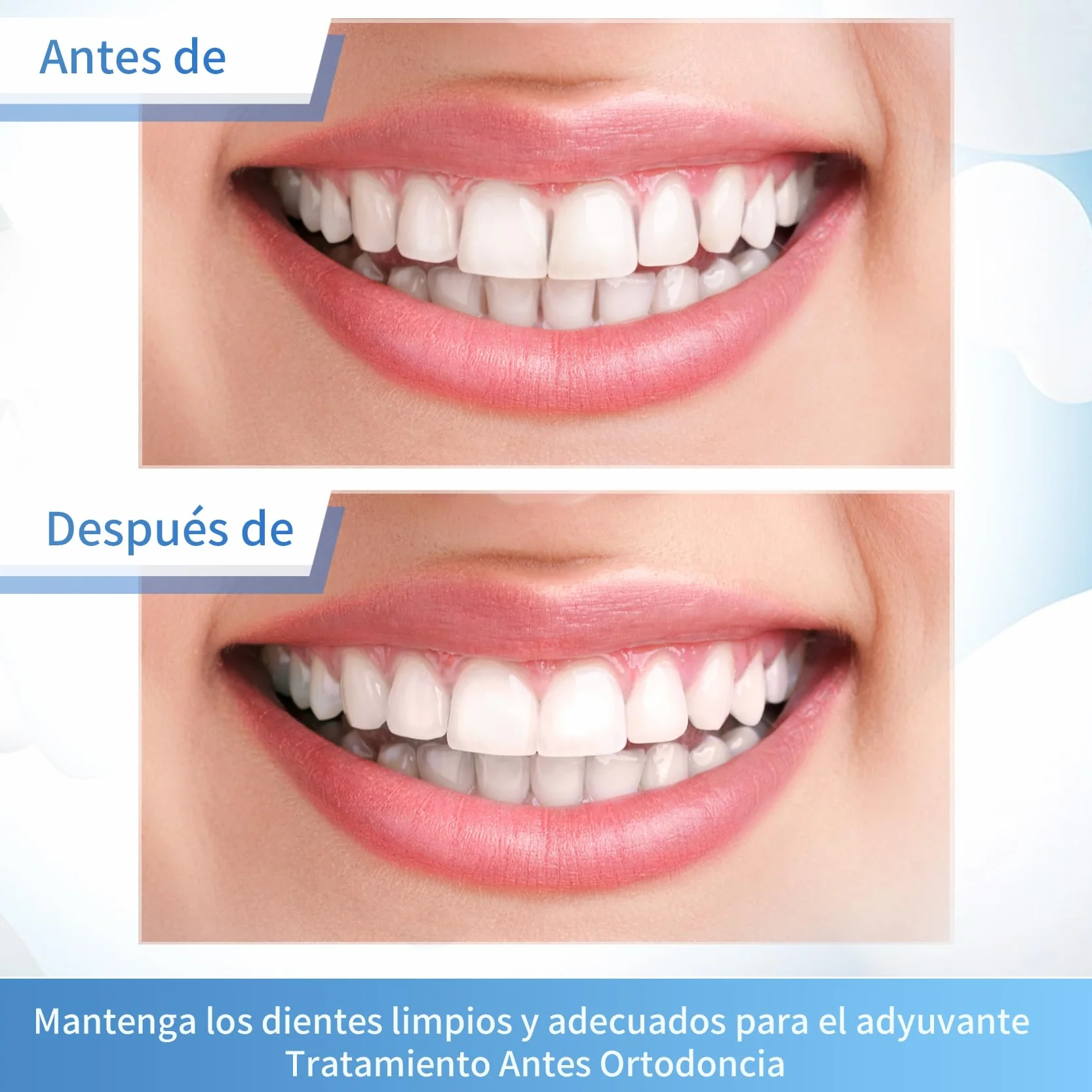 Annhua Tiras de Pulido Dental Abrasivo y Acabado 4mm x 6M Fine Azul