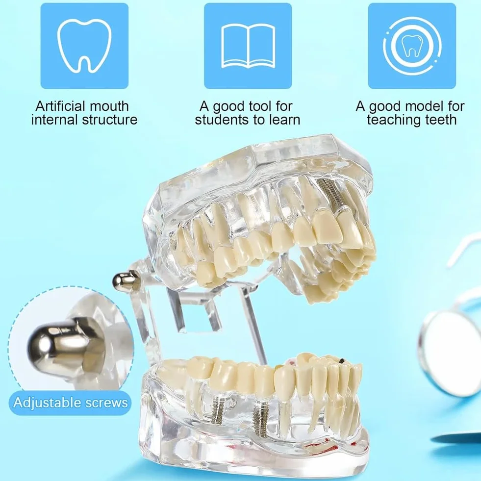 Typodonts Dental Modelo de Dientes para Implantes con Dientes Desmontables